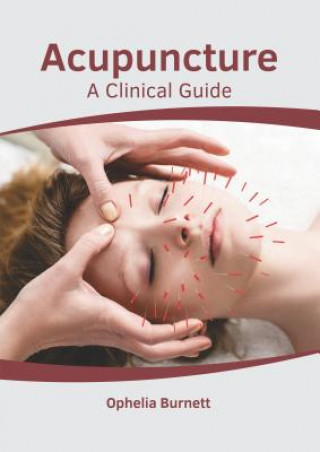 Kniha Acupuncture: A Clinical Guide Ophelia Burnett