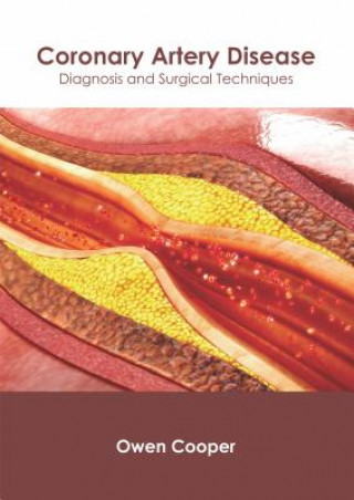 Könyv Coronary Artery Disease: Diagnosis and Surgical Techniques Owen Cooper