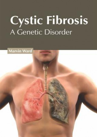 Knjiga Cystic Fibrosis: A Genetic Disorder Marvin Ward