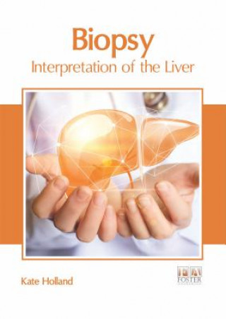 Kniha Biopsy: Interpretation of the Liver Kate Holland