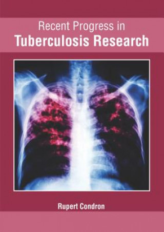 Knjiga Recent Progress in Tuberculosis Research Rupert Condron