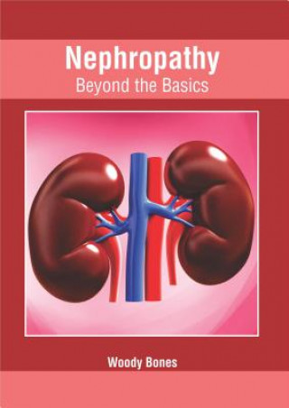 Könyv Nephropathy: Beyond the Basics Woody Bones