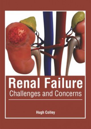 Knjiga Renal Failure: Challenges and Concerns Hugh Colley