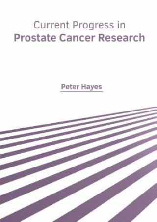 Kniha Current Progress in Prostate Cancer Research Peter Hayes