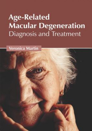 Könyv Age-Related Macular Degeneration: Diagnosis and Treatment Veronica Martin