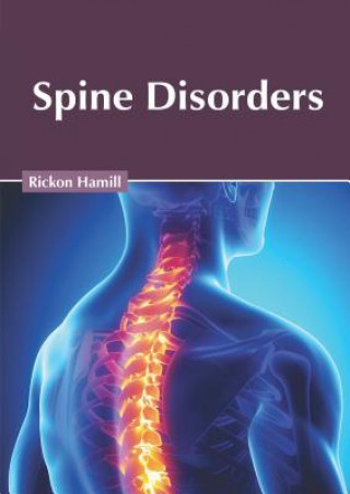 Buch Spine Disorders Rickon Hamill