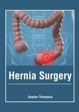 Könyv Hernia Surgery Kayden Thompson