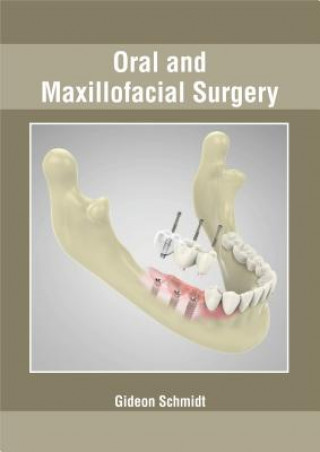 Kniha Oral and Maxillofacial Surgery Gideon Schmidt