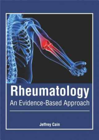 Kniha Rheumatology: An Evidence-Based Approach Jeffrey Cain