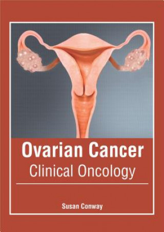 Kniha Ovarian Cancer: Clinical Oncology Susan Conway