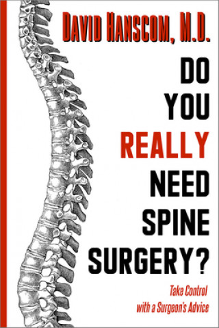 Könyv Do You Really Need Spine Surgery? David Hanscom