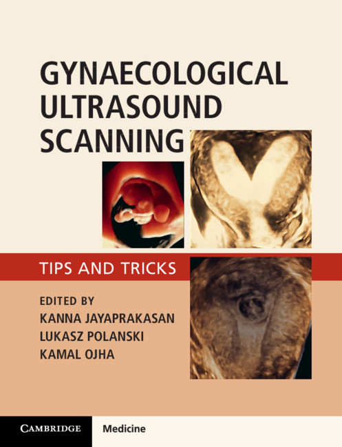 Kniha Gynaecological Ultrasound Scanning Kanna Jayaprakasan
