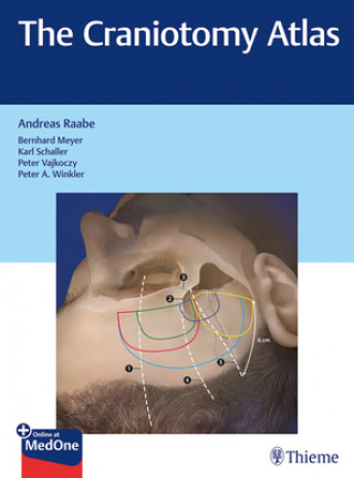 Книга Craniotomy Atlas Andreas Raabe