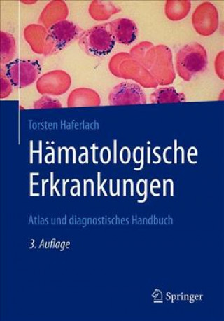 Kniha Hamatologische Erkrankungen Torsten Haferlach