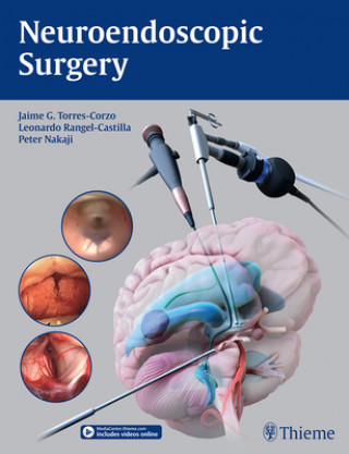 Kniha Neuroendoscopic Surgery 