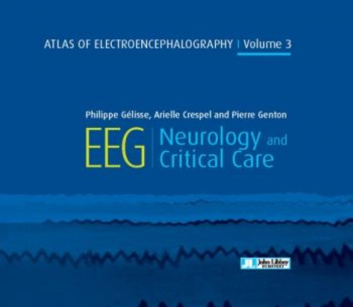 Carte Atlas of Electroencephalography Volume 3 PHILIPPE GELISSE