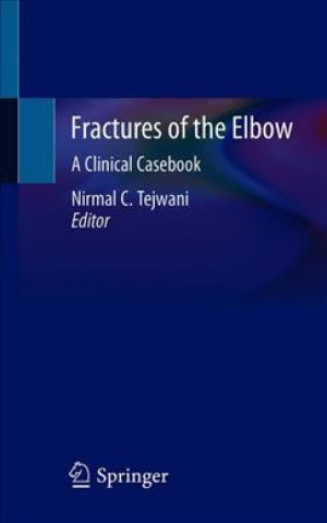 Carte Fractures of the Elbow Nirmal C. Tejwani