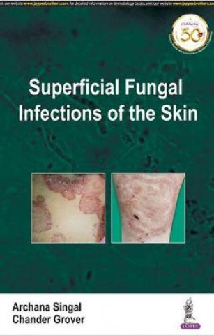 Carte Superficial Fungal Infections of the Skin Archana Singal
