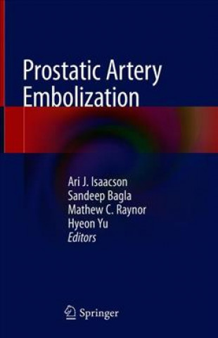 Knjiga Prostatic Artery Embolization Ari J. Isaacson
