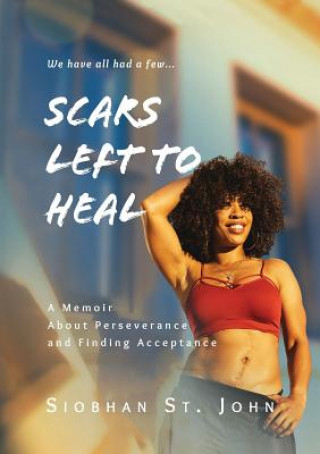 Buch Scars Left To Heal: A Memoir About Perseverance and Finding Acceptance Siobhan St John