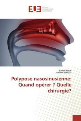 Carte Polypose nasosinusienne: Quand opérer ? Quelle chirurgie? Sameh Mezri