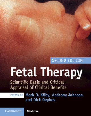 Book Fetal Therapy Mark D. Kilby