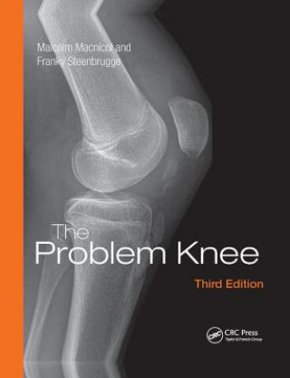 Kniha Problem Knee Macnicol