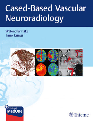 Könyv Imaging in Neurovascular Disease Waleed Brinjikji