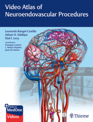 Kniha Video Atlas of Neuroendovascular Procedures Leonardo Rangel-Castilla