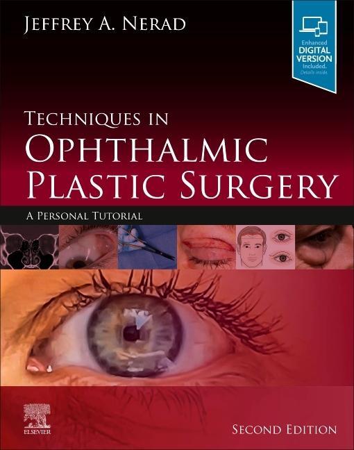 Kniha Techniques in Ophthalmic Plastic Surgery Jeffrey A. Nerad