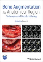 Kniha Bone Augmentation by Anatomical Region 