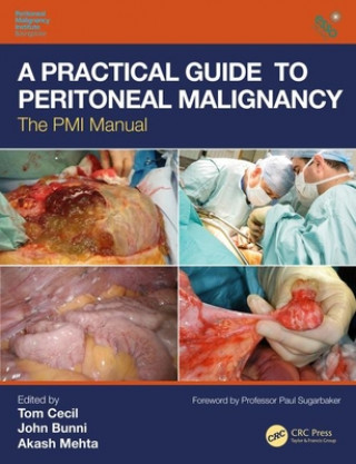 Livro Practical Guide to Peritoneal Malignancy Akash Mehta