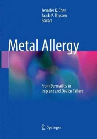 Książka Metal Allergy Jennifer K Chen