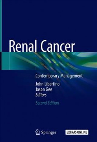 Książka Renal Cancer John Libertino