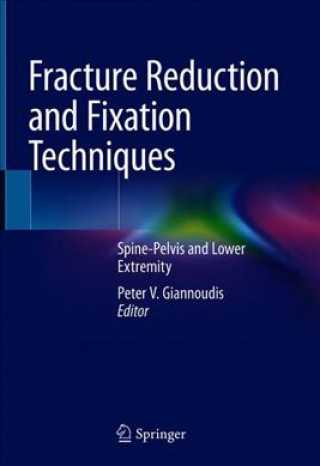 Kniha Fracture Reduction and Fixation Techniques Peter V. Giannoudis