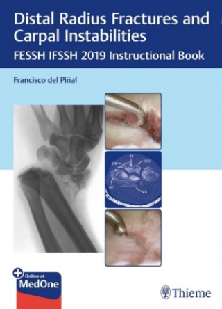 Könyv Distal Radius Fractures and Carpal Instabilities Francisco Del Pinal