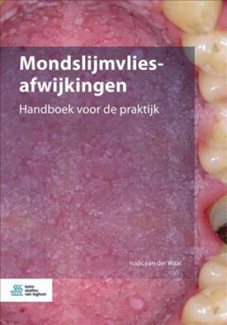 Kniha Mondslijmvliesafwijkingen Isaac Van Der Waal