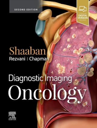 Kniha Diagnostic Imaging: Oncology Akram M. Shaaban