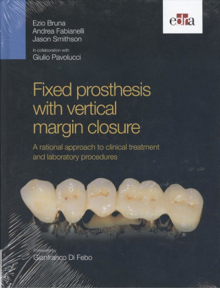 Knjiga FIXED PROSTHESIS WITH VERTICAL MARGIN CL EZIO BRUNA