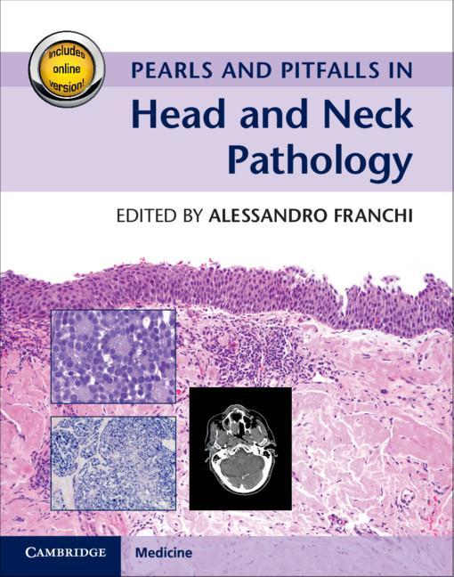 Kniha Pearls and Pitfalls in Head and Neck Pathology with Online Resource Alessandro Franchi