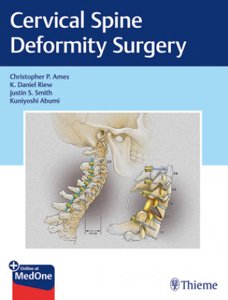 Knjiga Cervical Spine Deformity Surgery Christopher Ames