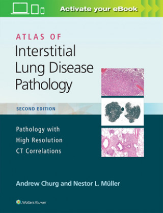 Kniha Atlas of Interstitial Lung Disease Pathology Andrew Churg