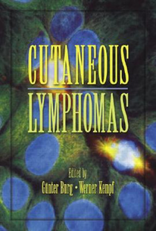 Knjiga Cutaneous Lymphomas Gunter Burg