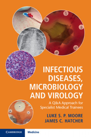 Kniha Infectious Diseases, Microbiology and Virology LUKE MOORE