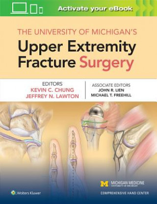 Könyv University of Michigan's Upper Extremity Fracture Surgery Chung