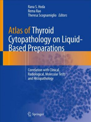 Knjiga Atlas of Thyroid Cytopathology on Liquid-Based Preparations Rana S. Hoda