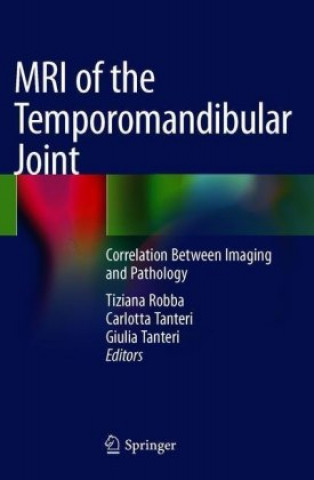 Knjiga MRI of the Temporomandibular Joint Tiziana Robba