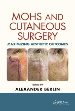 Książka Mohs and Cutaneous Surgery 