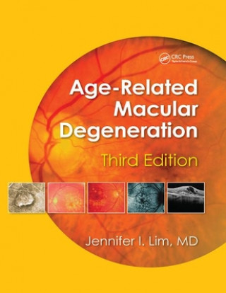 Kniha Age-Related Macular Degeneration 