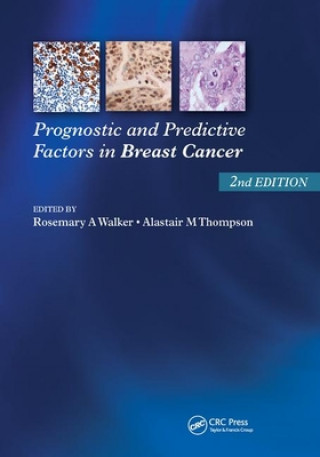 Kniha Prognostic and Predictive Factors in Breast Cancer 